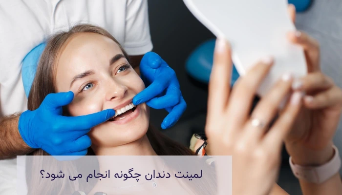 مراحل لمینت دندان