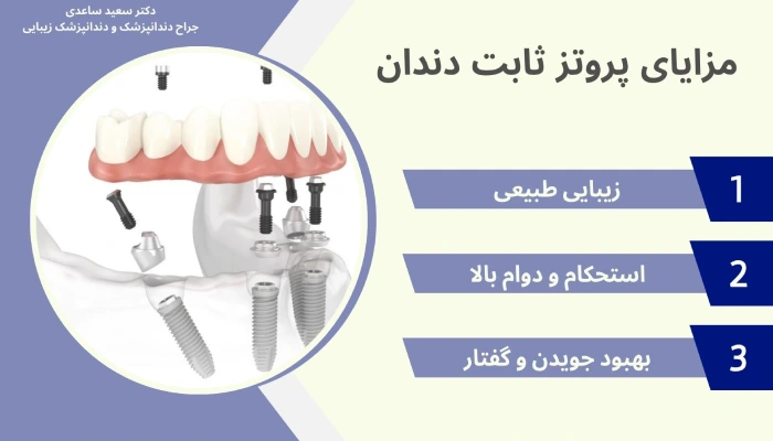 مزایای پروتز ثابت دندان