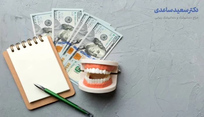 قیمت ایمپلنت دندان