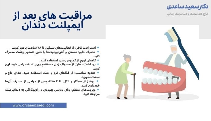 مراقبت های بعد از ایمپلنت دندان چیست؟