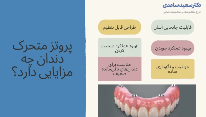 مزایای پروتز متحرک دندان