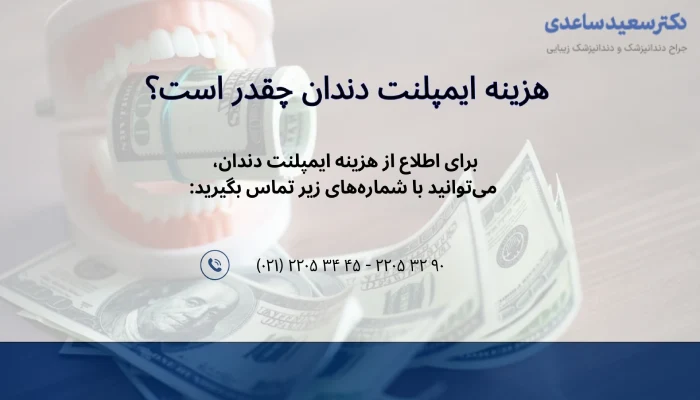 هزینه ایمپلنت دندان چقدره؟
