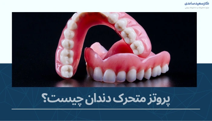 پروتز متحرک دندان چیست؟