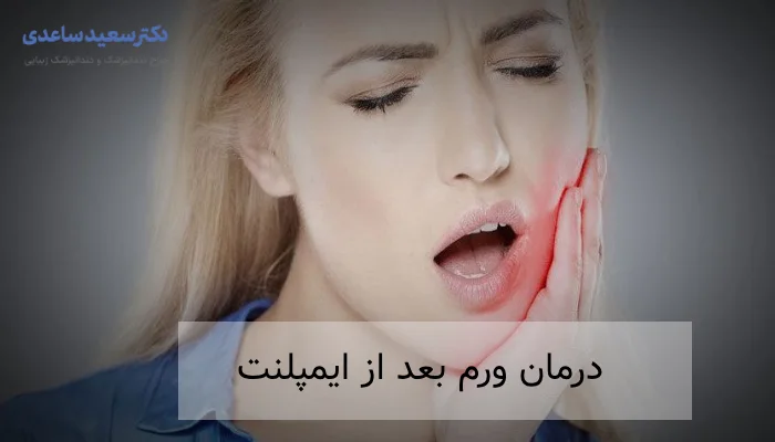 درمان ورم بعد از ایمپلنت
