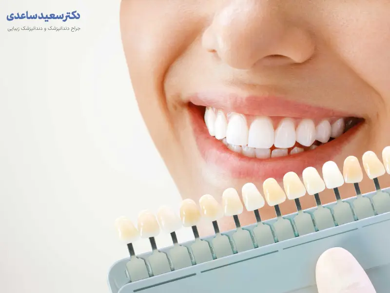 روکش زیرکونیوم