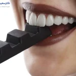 مراقبت های بعد از لمینت دندان