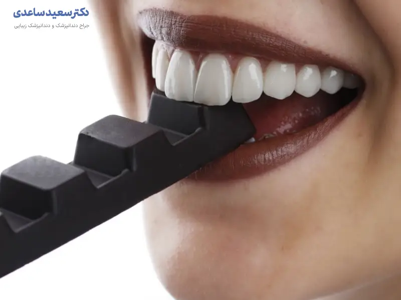 مراقبت های بعد از لمینت دندان