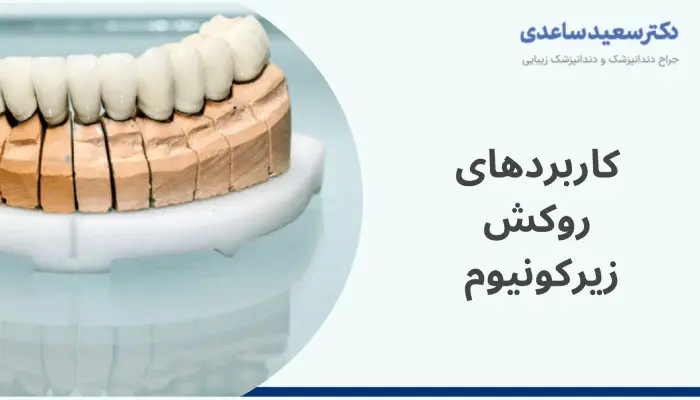 کاربردهای روکش زیرکونیوم 