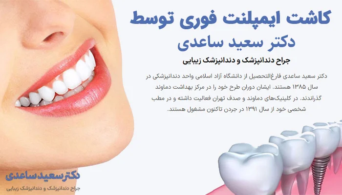 تبلیغ کاشت ایمپلنت فوری توسط دکتر سعید ساعدی با تصویر لبخند و ایمپلنت‌های دندانی