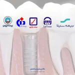 تصویر لوگوهای بیمه ایرانی روی زمینه ایمپلنت دندان