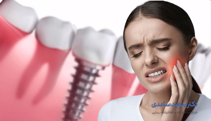 درد ایمپلنت