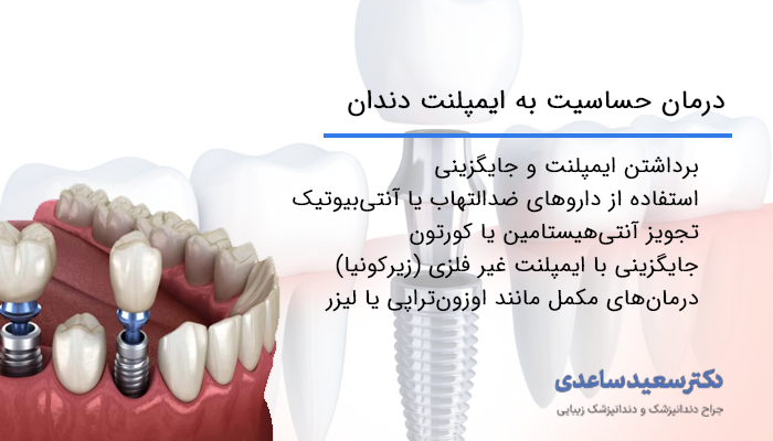 نمایش ایمپلنت دندان و روش‌های درمان حساسیت به آن