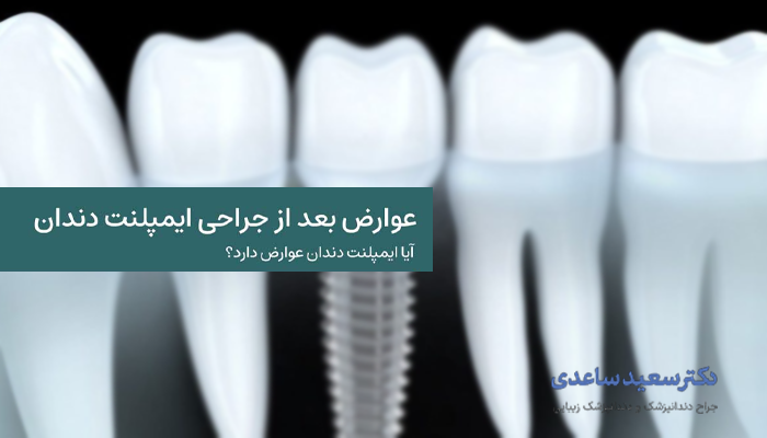 عوارض جراحی ایمپلنت
