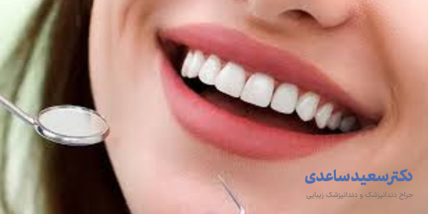 مراقبت قبل از لمینت دندان