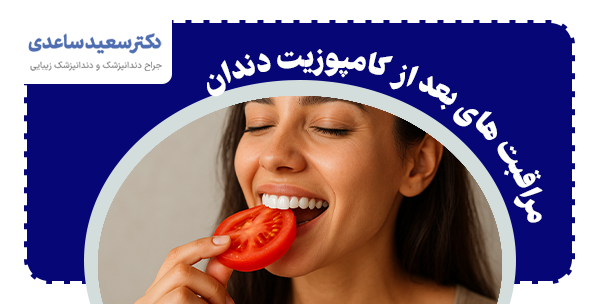 مراقبت های بعد از کامپوزیت دندان