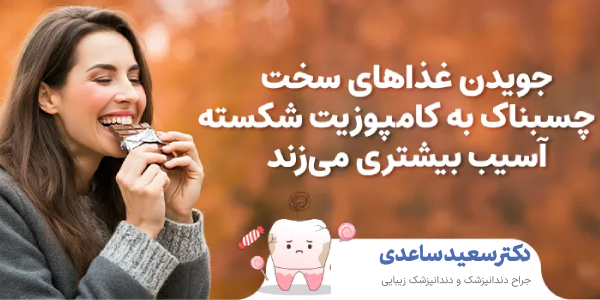 مراقبت های بعد از کامپوزیت دندان