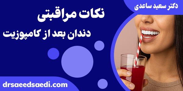 نکات مراقبتی بعد از کامپوزیت