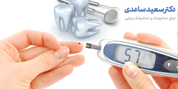 ایمپلنت برای افراد دیابتی