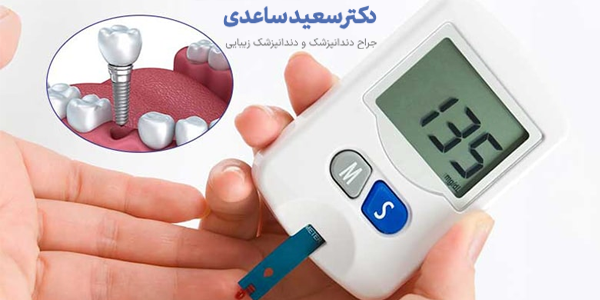 ایمپلنت برای افراد دیابتی