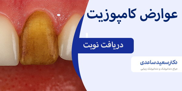 علت بروز عوارض کامپوزیت