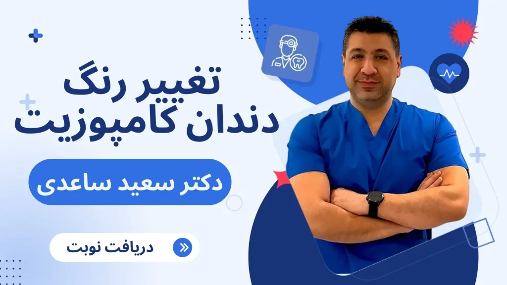 روشهای پیشگیری از تغییر رنگ کامپوزیت