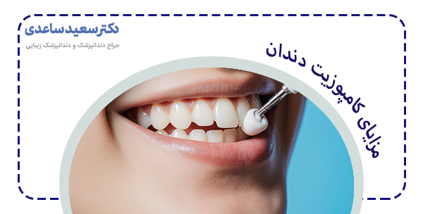 مزایای کامپوزیت دندان برای ترمیم