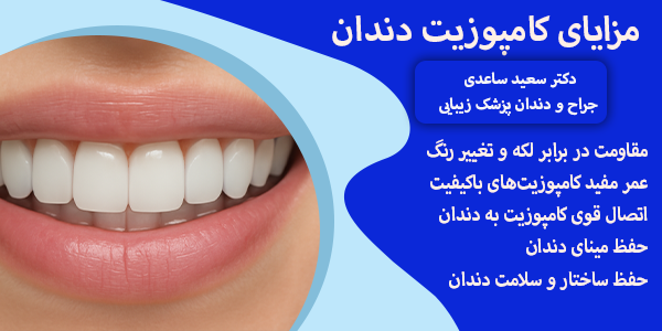 مزایای کامپوزیت چیست