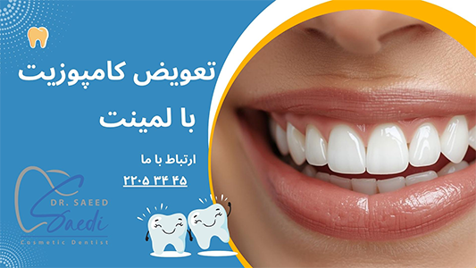 تعویض کامپوزیت با لیمنت چیست