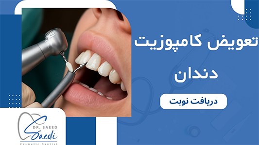 تعویض کامپوزیت دندان چیست