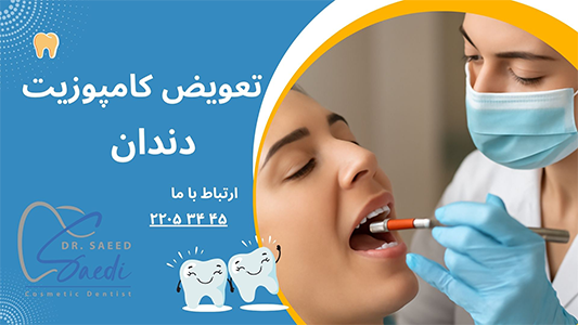 مراحل تعویض کامپوزیت دندان